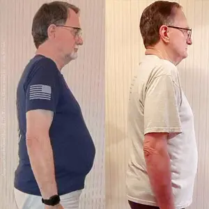 Harry's before and after health transformation