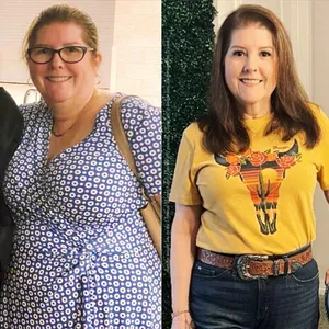 Karla's before and after health transformation